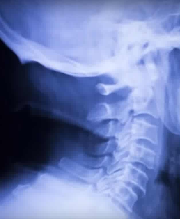 WWE盘点险些命丧擂台的摔角手，有一个只有17岁！肛门撕裂那个真别笑