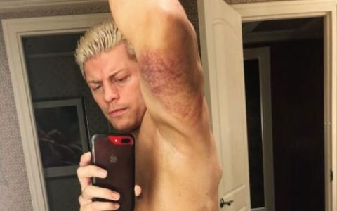 WWE超级巨星在皇家大赛中被打掉一颗牙齿