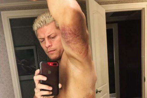 WWE超级巨星在皇家大赛中被打掉一颗牙齿