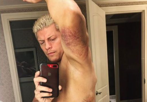 WWE超级巨星在皇家大赛中被打掉一颗牙齿