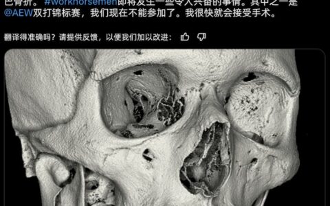 AEW选手在比赛中下巴骨折，准备接受手术治疗