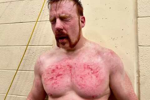 希莫斯在WWE RAW激战后展示血迹斑斑的胸部，宣布与冈瑟的恩怨结束