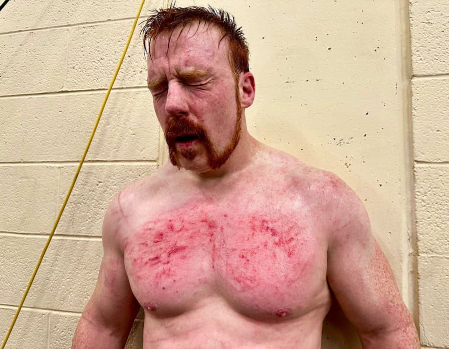 希莫斯在WWE RAW激战后展示血迹斑斑的胸部，宣布与冈瑟的恩怨结束