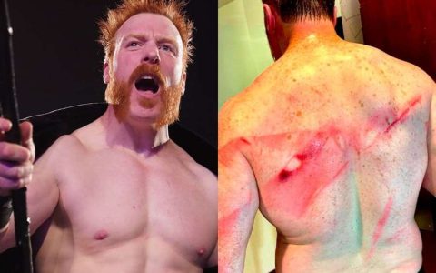 惨烈！希莫斯WWE幸存者大赛后伤痕累累！