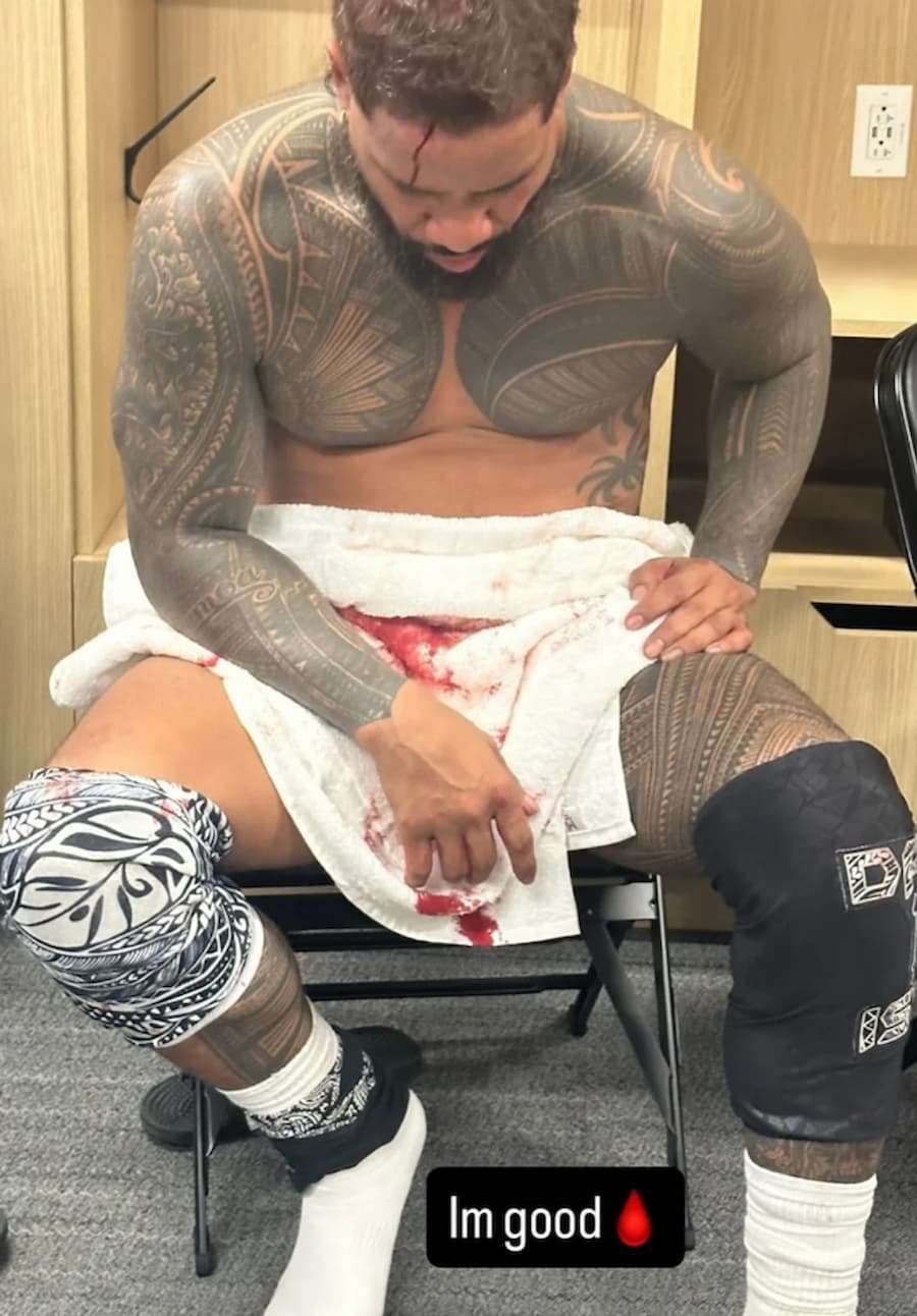 WWE WrestlePalooza 赛事中,一场备受瞩目的双打对决因意外状况紧急收场。深受粉丝喜爱的超级巨星杰·乌索(Jey Uso)