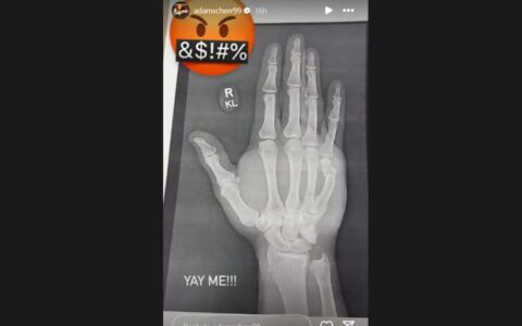 前 WWE 环球冠军布朗·斯图曼再遭伤病袭击，手腕骨折引发职业生涯新忧虑！