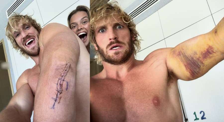洛根·保罗(Logan Paul)。