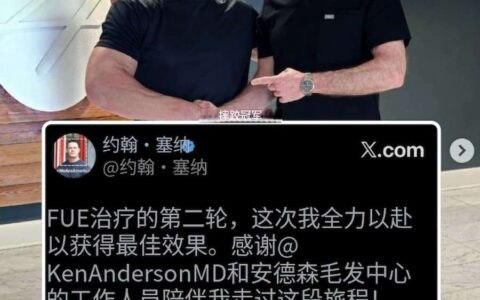 约翰·塞纳剃光头亮相！二次植发后公开新造型，退役后的他正在为人生下半场重新铺路