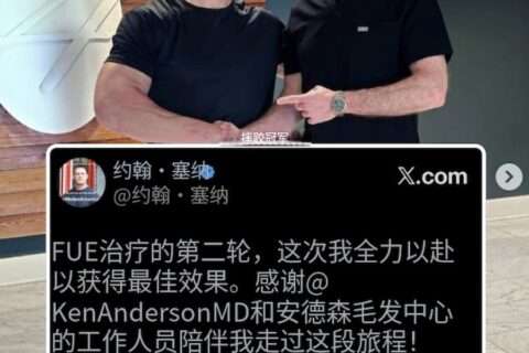 约翰·塞纳剃光头亮相！二次植发后公开新造型，退役后的他正在为人生下半场重新铺路