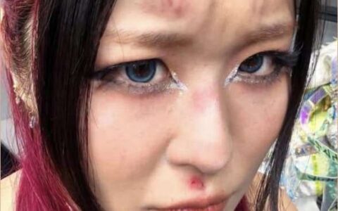 紫雷赛后遭审判日多人围殴头部淤青，夏季狂潮女子冠军战悬念加剧